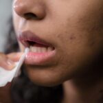 Why Your Acne Won’t Clear Up in Malaysia’s Heat